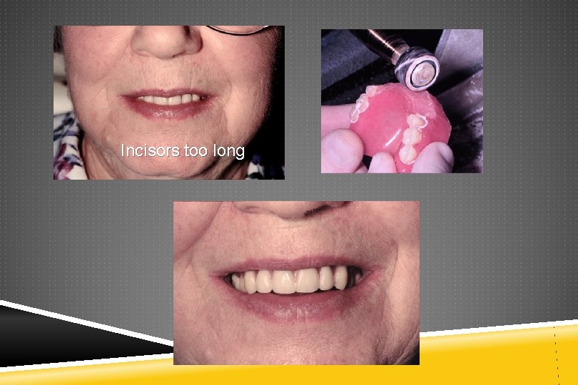 Incisors too long 