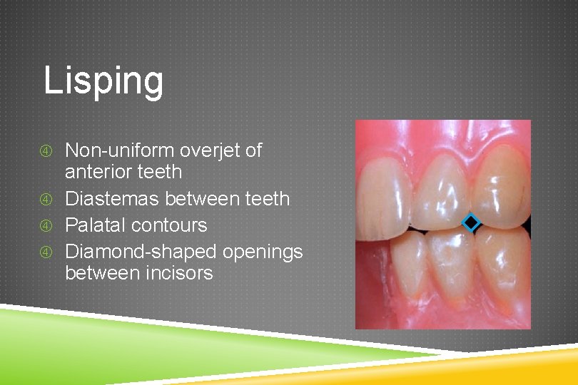 Lisping Non-uniform overjet of anterior teeth Diastemas between teeth Palatal contours Diamond-shaped openings between