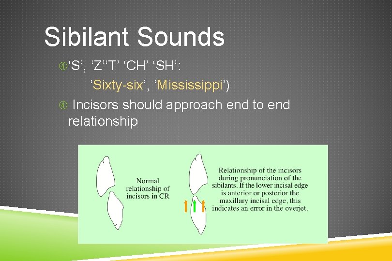 Sibilant Sounds ‘S’, ‘Z’‘T’ ‘CH’ ‘SH’: ‘Sixty-six’, ‘Mississippi’) Incisors should approach end to end
