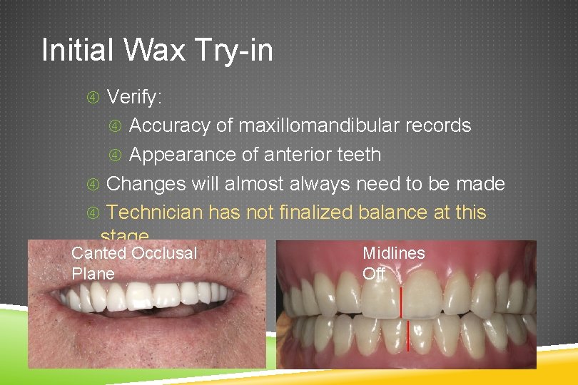 Initial Wax Try-in Verify: Accuracy of maxillomandibular records Appearance of anterior teeth Changes will