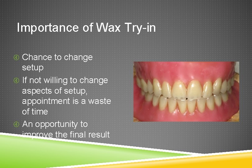 Importance of Wax Try-in Chance to change setup If not willing to change aspects