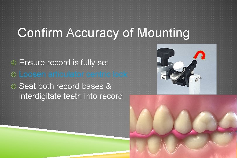 Confirm Accuracy of Mounting Ensure record is fully set Loosen articulator centric lock Seat
