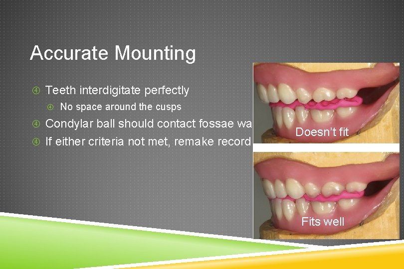 Accurate Mounting Teeth interdigitate perfectly No space around the cusps Condylar ball should contact