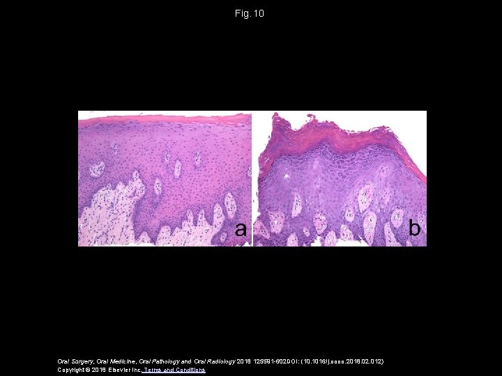 Fig.  10 Oral Surgery, Oral Medicine, Oral Pathology and Oral Radiology 2018 125591 -602