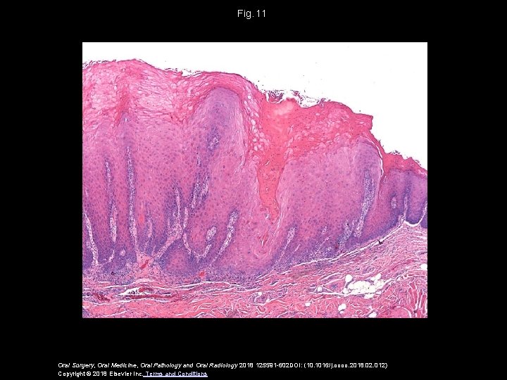 Fig.  11 Oral Surgery, Oral Medicine, Oral Pathology and Oral Radiology 2018 125591 -602