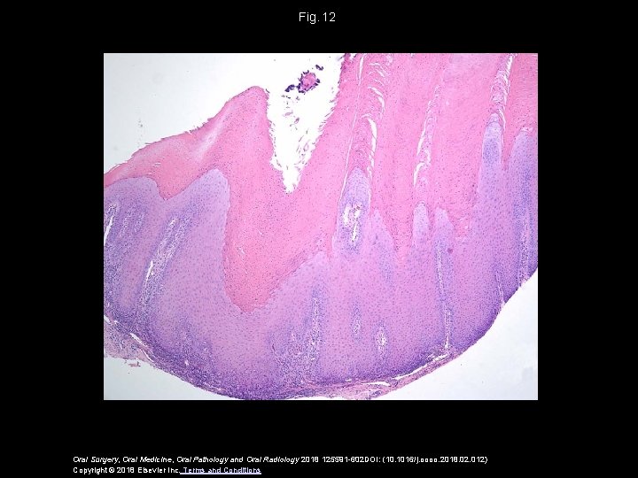 Fig.  12 Oral Surgery, Oral Medicine, Oral Pathology and Oral Radiology 2018 125591 -602