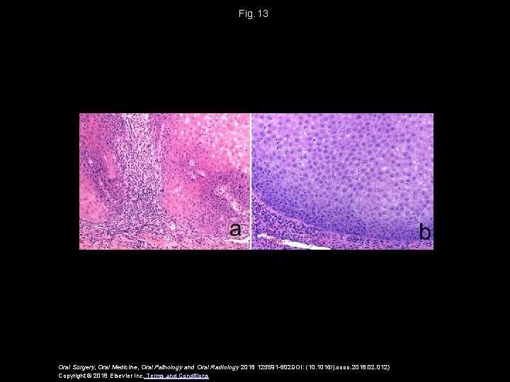 Fig.  13 Oral Surgery, Oral Medicine, Oral Pathology and Oral Radiology 2018 125591 -602