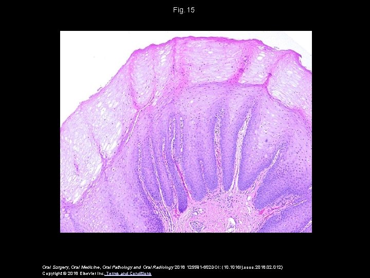 Fig.  15 Oral Surgery, Oral Medicine, Oral Pathology and Oral Radiology 2018 125591 -602