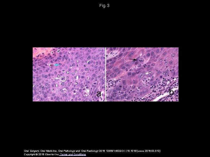 Fig.  3 Oral Surgery, Oral Medicine, Oral Pathology and Oral Radiology 2018 125591 -602