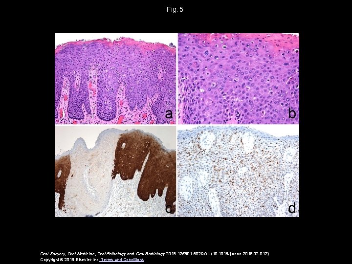 Fig.  5 Oral Surgery, Oral Medicine, Oral Pathology and Oral Radiology 2018 125591 -602