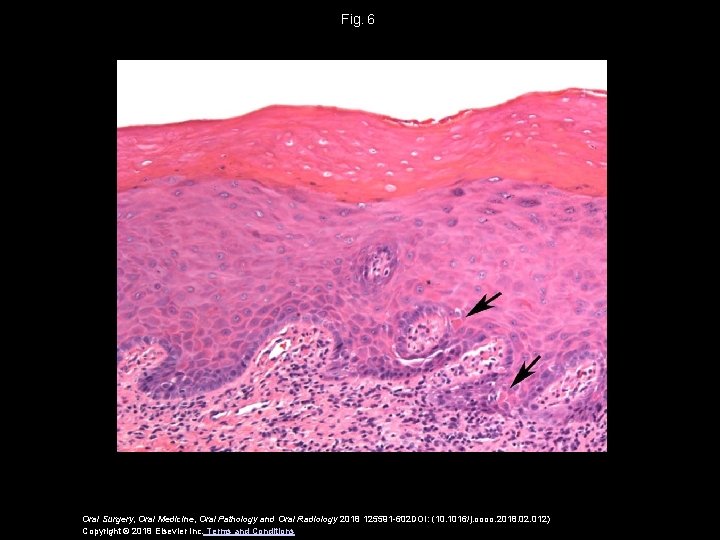 Fig.  6 Oral Surgery, Oral Medicine, Oral Pathology and Oral Radiology 2018 125591 -602