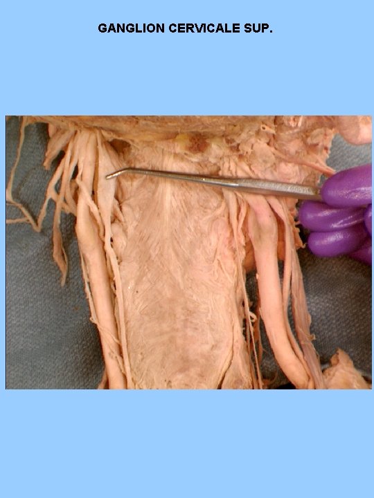 GANGLION CERVICALE SUP. GANGLION CERVICALE SUP.