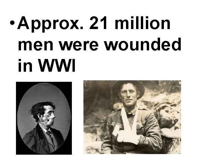  • Approx. 21 million men were wounded in WWI 