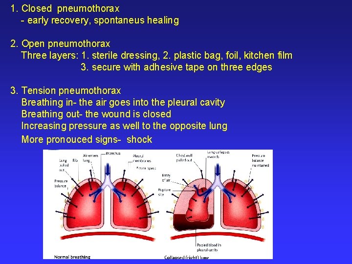 1. Closed pneumothorax - early recovery, spontaneus healing 2. Open pneumothorax Three layers: 1.