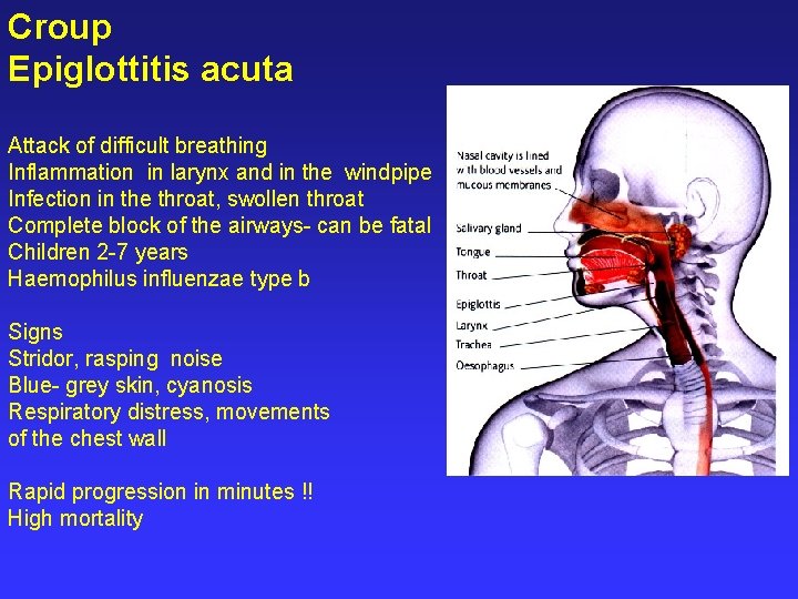 Croup Epiglottitis acuta Attack of difficult breathing Inflammation in larynx and in the windpipe