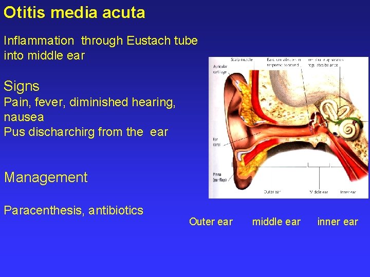 Otitis media acuta Inflammation through Eustach tube into middle ear Signs Pain, fever, diminished