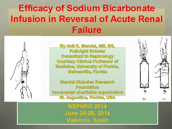 Efficacy of Sodium Bicarbonate Infusion in Reversal of Acute Renal Failure By Anil K.