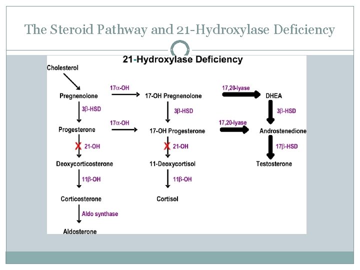 The Steroid Pathway and 21 -Hydroxylase Deficiency 