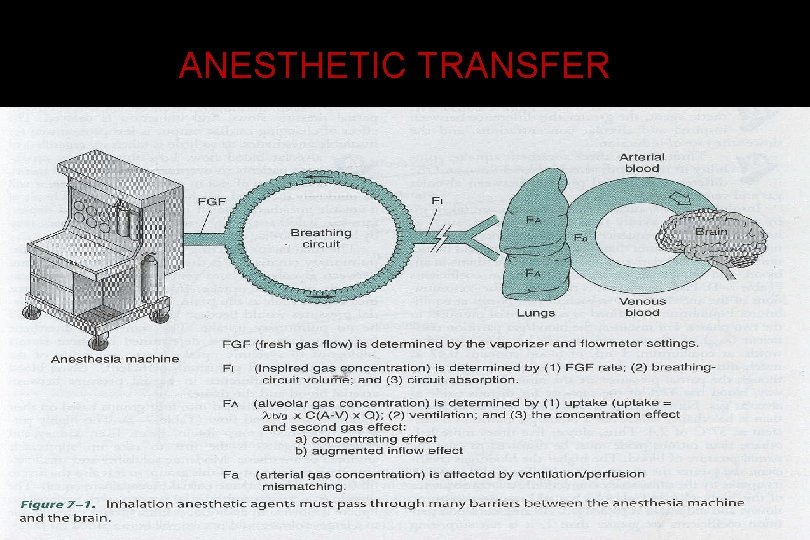 ANESTHETIC TRANSFER 
