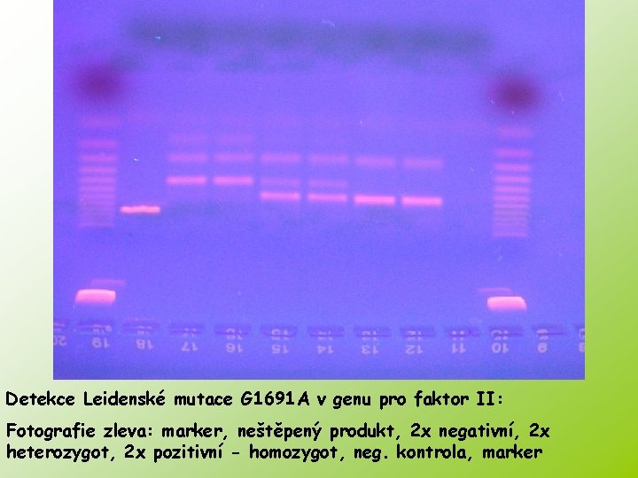 Detekce Leidenské mutace G 1691 A v genu pro faktor II: Fotografie zleva: marker,