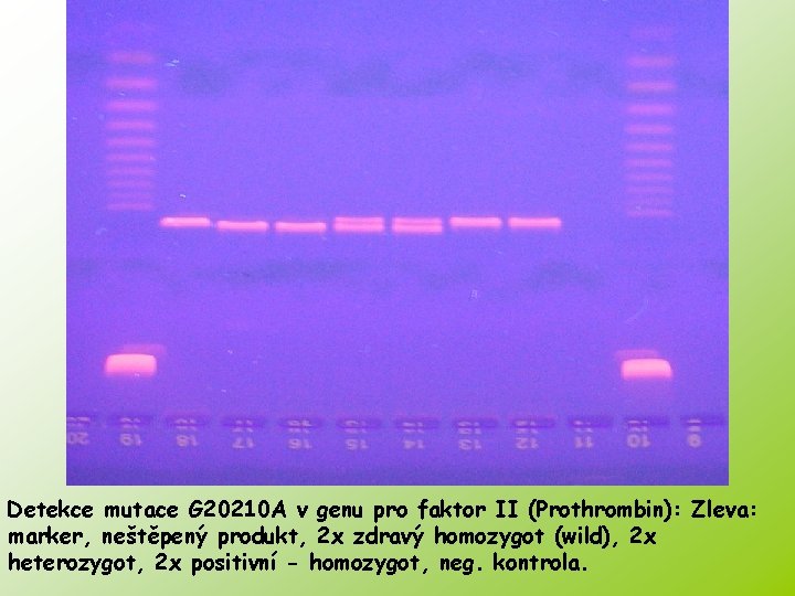Detekce mutace G 20210 A v genu pro faktor II (Prothrombin): Zleva: marker, neštěpený