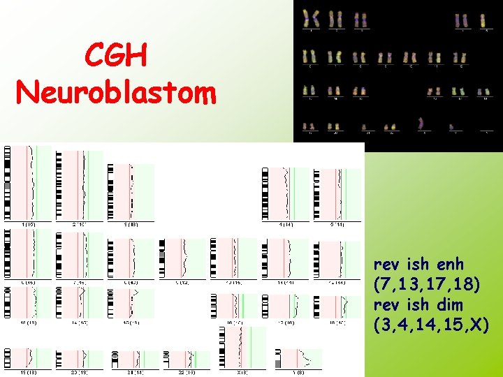 CGH Neuroblastom rev ish enh (7, 13, 17, 18) rev ish dim (3, 4,