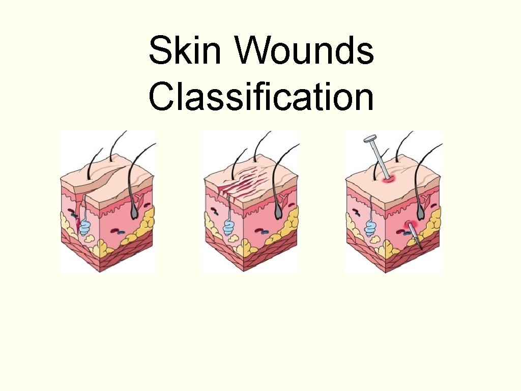 Skin Wounds Classification 