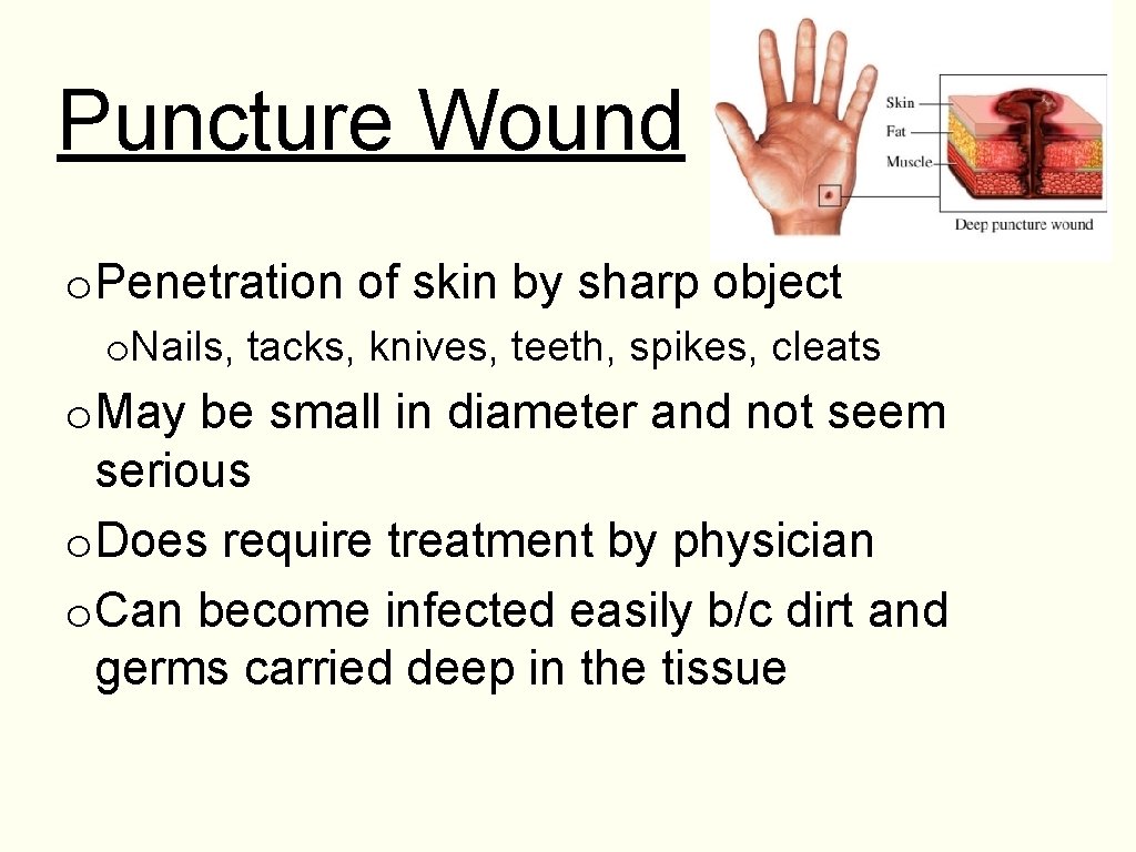 Puncture Wound o. Penetration of skin by sharp object o. Nails, tacks, knives, teeth,