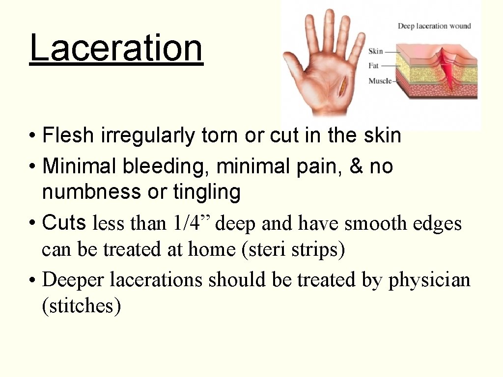 Laceration • Flesh irregularly torn or cut in the skin • Minimal bleeding, minimal