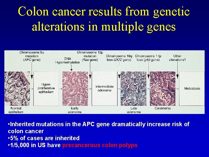Colon cancer results from genetic alterations in multiple genes • Inherited mutations in the Colon cancer results from genetic alterations in multiple genes • Inherited mutations in the