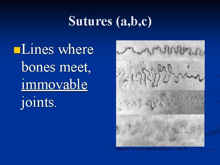 Sutures (a, b, c) n Lines where bones meet, immovable joints. 
