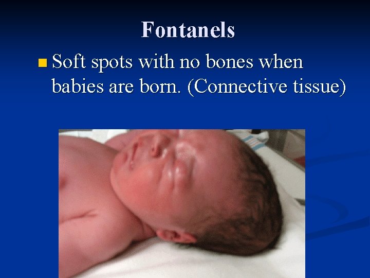 Fontanels n Soft spots with no bones when babies are born. (Connective tissue) 