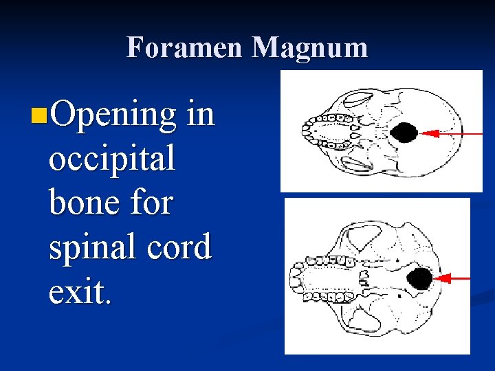 Foramen Magnum n. Opening in occipital bone for spinal cord exit. 