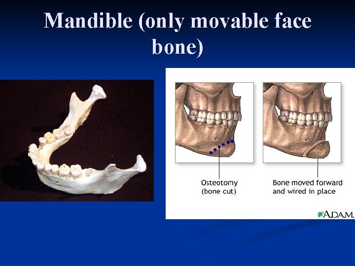Mandible (only movable face bone) 