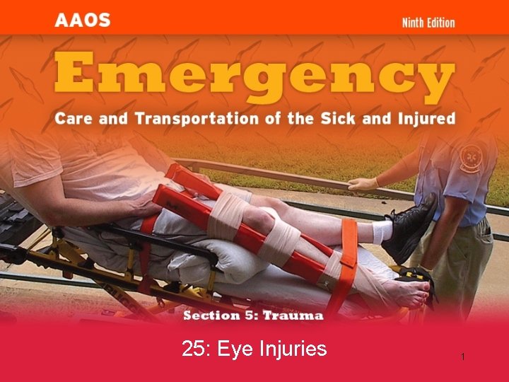 25: Eye Injuries 1 