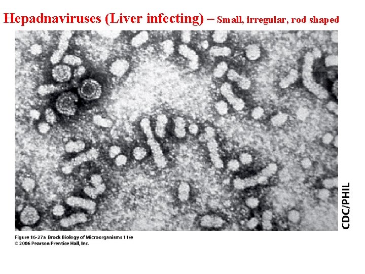 Hepadnaviruses (Liver infecting) – Small, irregular, rod shaped 