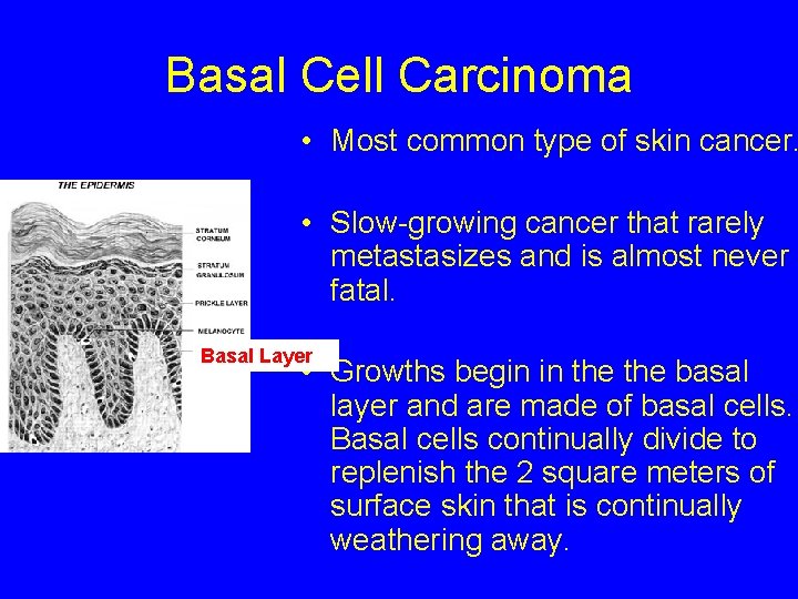 epithelioid malignant mesothelioma icd 10