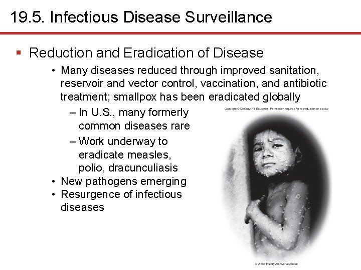 19. 5. Infectious Disease Surveillance § Reduction and Eradication of Disease • Many diseases