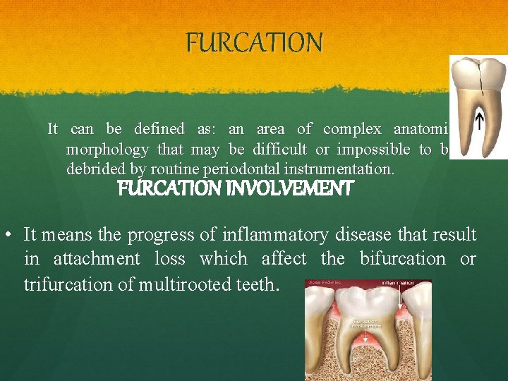 FURCATION It can be defined as: an area of complex anatomic morphology that may