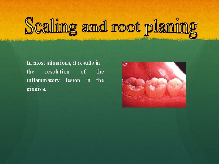 In most situations, it results in the resolution of the inflammatory lesion in the