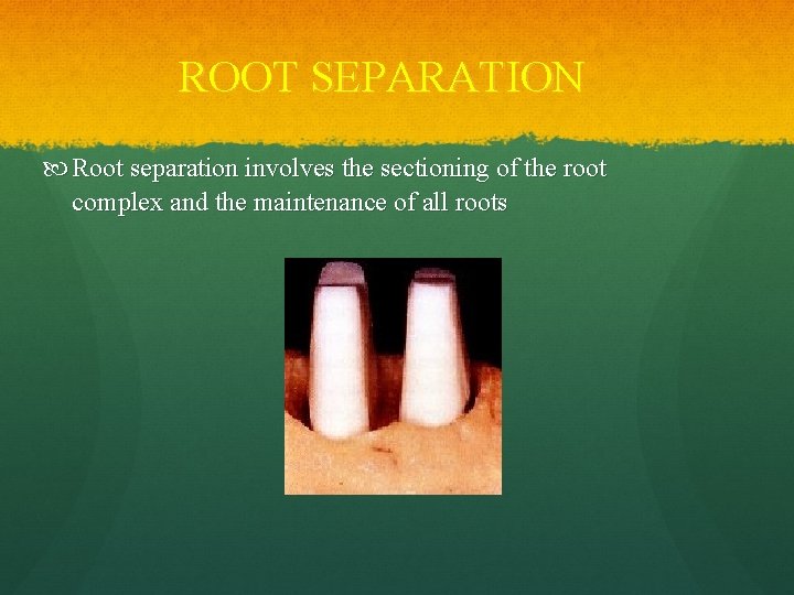 ROOT SEPARATION Root separation involves the sectioning of the root complex and the maintenance