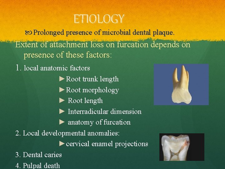 ETIOLOGY Prolonged presence of microbial dental plaque. Extent of attachment loss on furcation depends