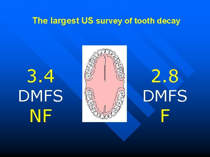 The largest US survey of tooth decay 3. 4 DMFS NF 2. 8 DMFS