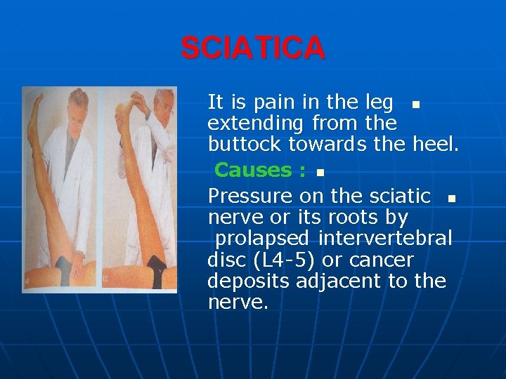 SCIATICA It is pain in the leg n extending from the buttock towards the