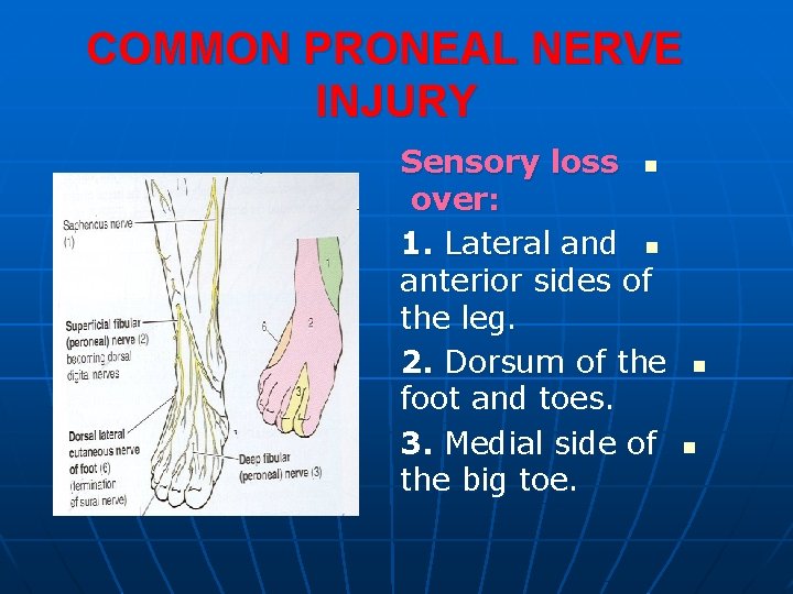 COMMON PRONEAL NERVE INJURY Sensory loss n over: 1. Lateral and n anterior sides