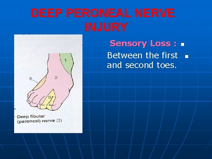 DEEP PERONEAL NERVE INJURY Sensory Loss : Between the first and second toes. n