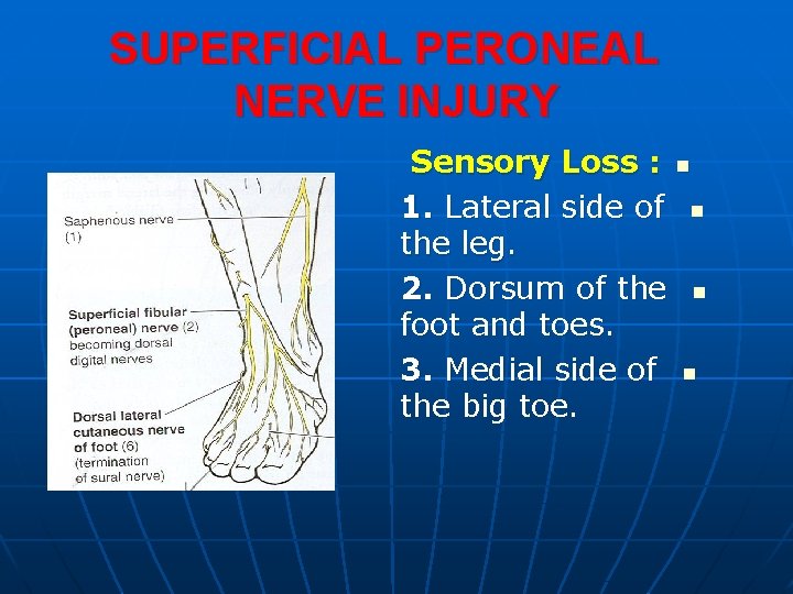 SUPERFICIAL PERONEAL NERVE INJURY Sensory Loss : n 1. Lateral side of n the