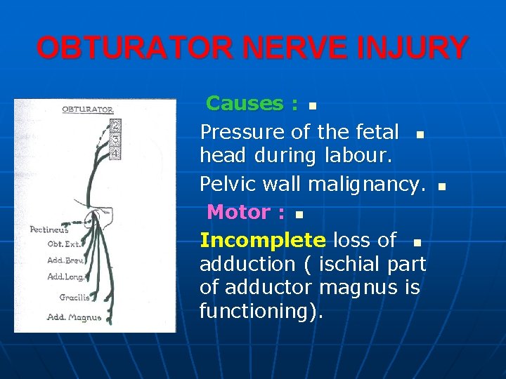 OBTURATOR NERVE INJURY Causes : n Pressure of the fetal n head during labour.