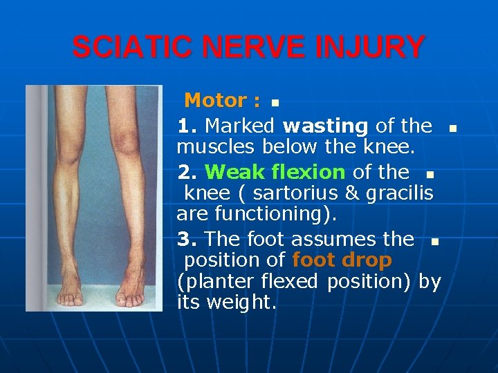 SCIATIC NERVE INJURY Motor : n 1. Marked wasting of the muscles below the