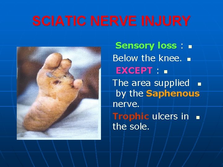 SCIATIC NERVE INJURY Sensory loss : n Below the knee. n EXCEPT : n